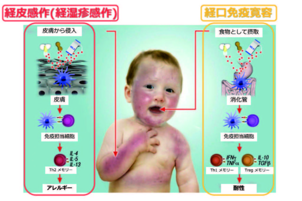 食物アレルギーをむやみに怖がらないで Drp