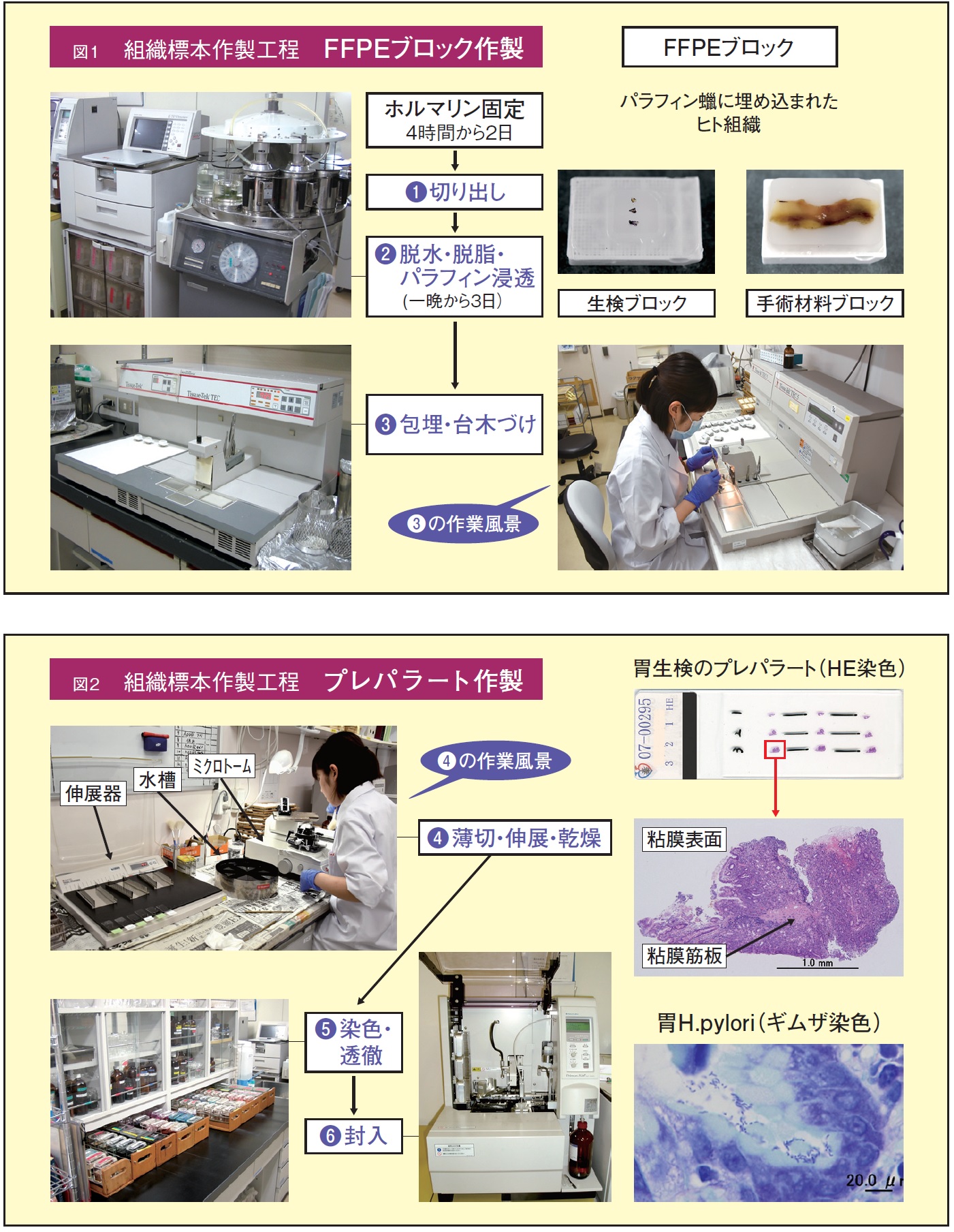 病理 組織 標本 の 作り方